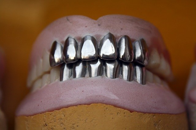 kovové zuby
